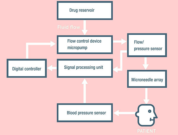 Medical Pressure Sensor used to control drug delivery